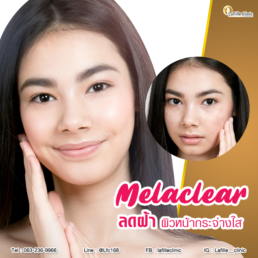 Melac01